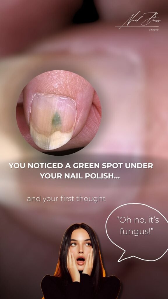Close-up of green spot under nail polish treated with russian manicure Tampa technique.