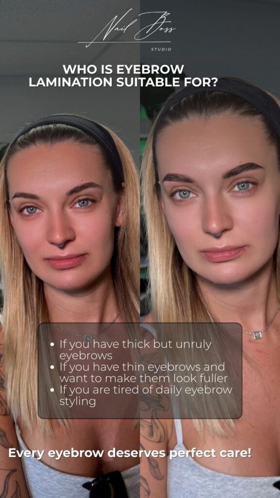 Before and after brow lift tampa transformation showing fuller lifted eyebrows in Tampa Florida.